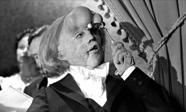 The Elephant Man The Elephant Man