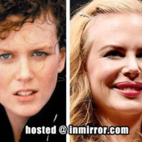 Nicole Kidman